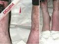Entrananet - Exclusivo Fotos de Michael Jackson com marcas de agulhas