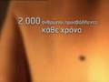 Melanoma