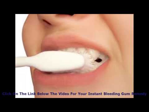 how to make your gums not bleed