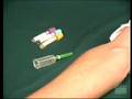 Performing Venepuncture