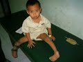 2006 pof aofas orthopedic surgical project