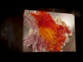 video thumbnail 2