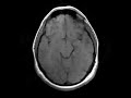 Axial Movie of my brain Axial Movie of my brain