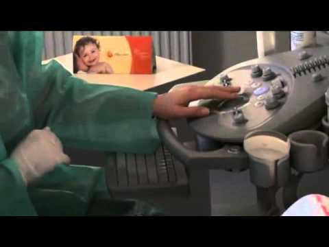 Видео: Амниоцентез при беременности