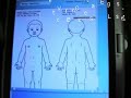 Medical Tablet PC evangalist