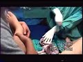 Amazing Baby Born