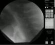 videos de Sword swallowing X Ray - Dai Andrews