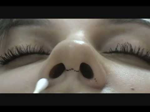 See video