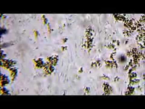 how to isolate aeromonas