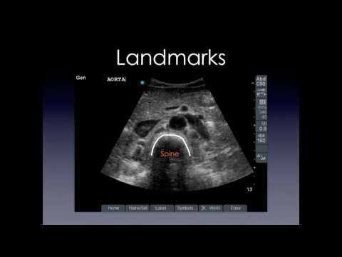 how to measure aorta on ultrasound