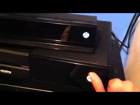 how to fix xbox one controller