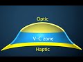 Boston Scleral Lens