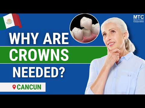 how to whiten crowns and bridges