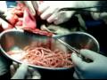Dr. Susanta Behera,MS(Surg.),Consultant:Gen. & Lap.Surgeon,LIFEWORTH HOSPITAL,Bhawanipatna,India Mobile-+919438757365