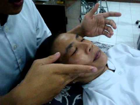 how to treat bell's palsy
