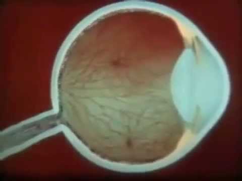 Видео Палочки и колбочки