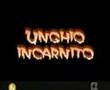 Unghio incarnito