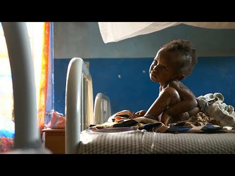 400.000 Kindern im Kongo droht der Hungertod