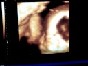 nuestra hijita Isabella Bruzzone Lopez