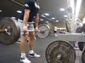 Deads - 315 x 17