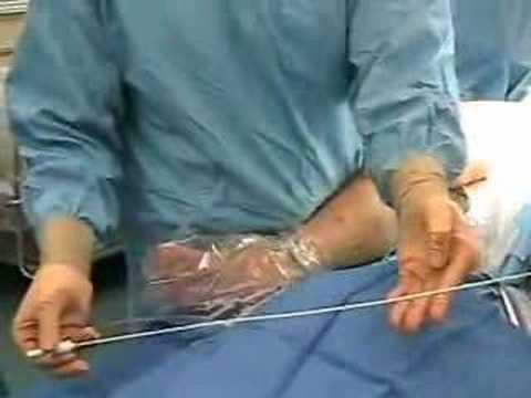 Dr Kirksey Varicose Vein Treatment ...