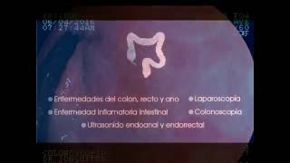 Luis Abraham Jonguitud Muro-6