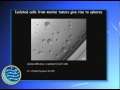 Dr Viale Speaks on t
