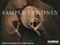 3D Medical Animation:  Coronary Artery Angiography (Cardiac