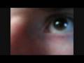 Eye Spasm