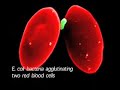 Blood Type Diet Movies #2: \