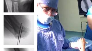 Omar Carlos Gonzalez Aparicio-12