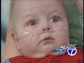 Healthbeat - Viagra for Babies