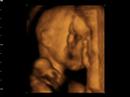 clare & nick 4d baby scan clare & nick 4d baby scan