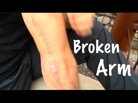Sparring Injuries Sparring Injuries