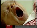 FALLUJAH BIRTH DEFECTS - THE US PERSONAL WAR