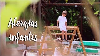Alergias infantis