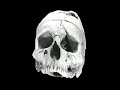 Phineas Gage Phineas Gage