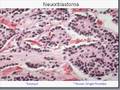 Medical School Pathology, Chapter 10k