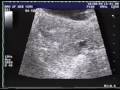 Exclusive: Inside the IVF Lab