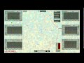 Nathan Myhrvold: Could this laser zap malaria?