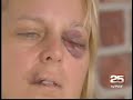 Lesley Dale Newsreel 2