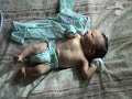 Tze Wei Jaundiced Sun Bath