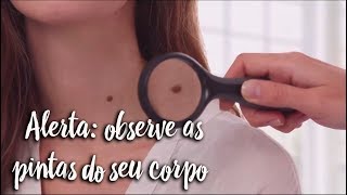 Fica a Dica - Alerta: observe as pintas do seu corpo
