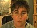 lose 100 pounds: day 72 Dermatomyositis