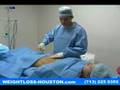 Smart Lipo - Tumescent Liposuction Surgery