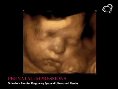 ultrasound 3d 4d - A 3D/4D Ultrasound taken of a baby that visited Prenatal Impressions, the only premier provider of 3D/4D Ultrasounds in Orlando, Florida since 2005. Prenatal...