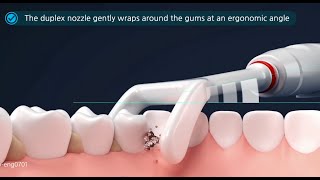 video thumbnail Water floss, Dental power cleaner,dental clinic, Oral cleaning, mouth wash youtube