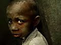 funny looking poor 3rd world black kid