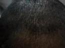 uma-careca-simp-tica
