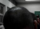 uma-careca-simp-tica